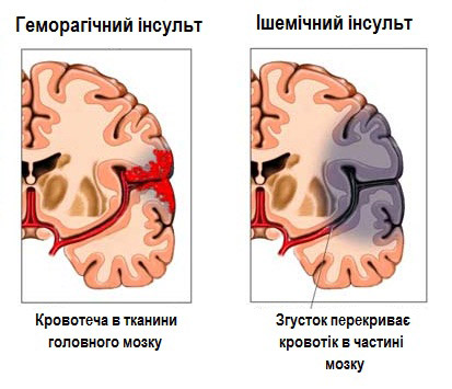 інс види картинка