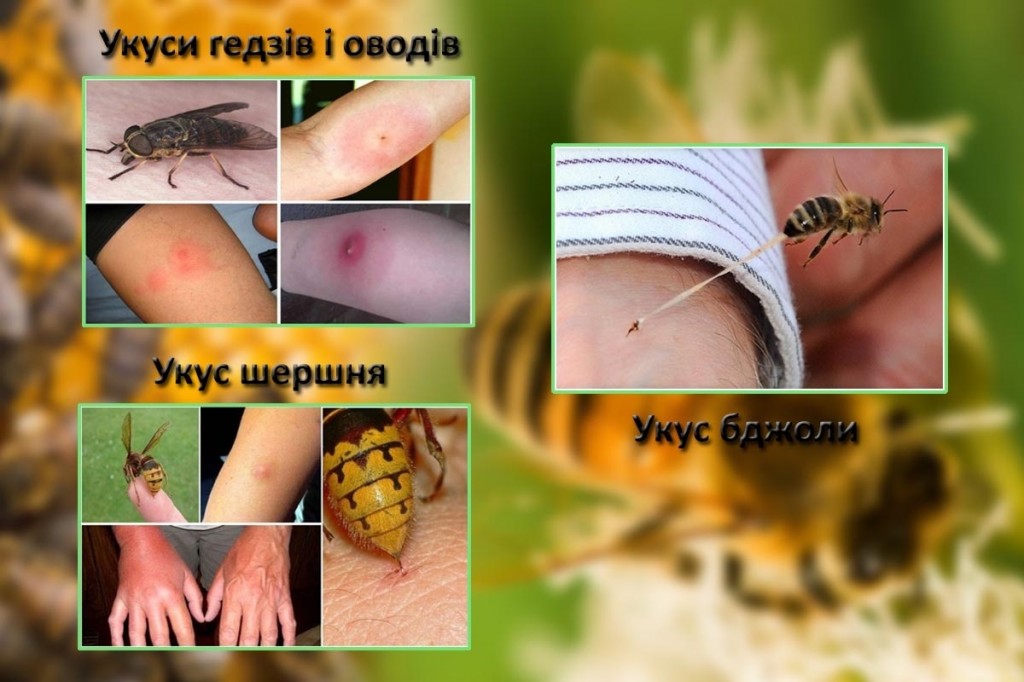 укус комах