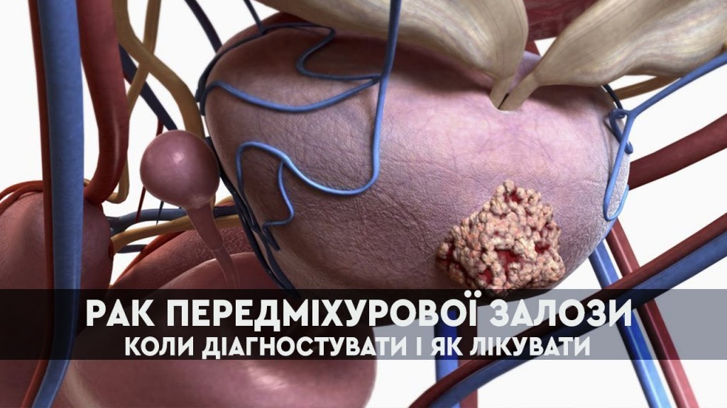 простат4