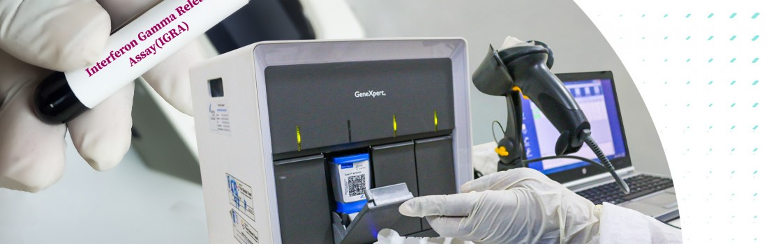 Сучасні методи діагностики ТБ