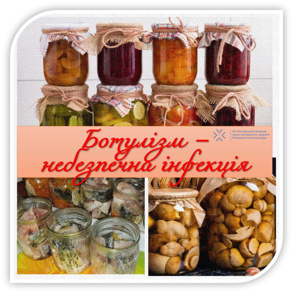 Ботулізм